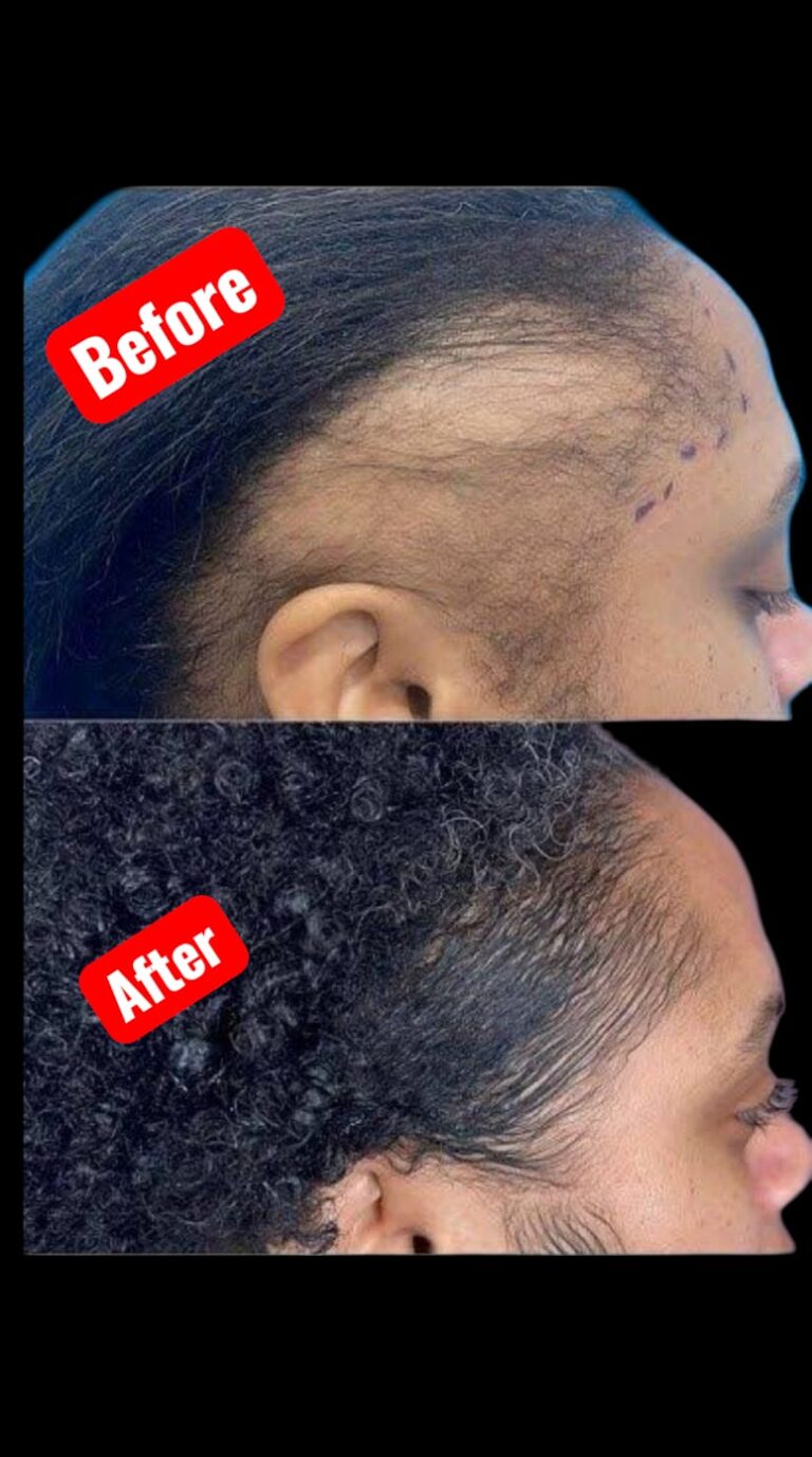 queens grow royal luxury africa before and after 1