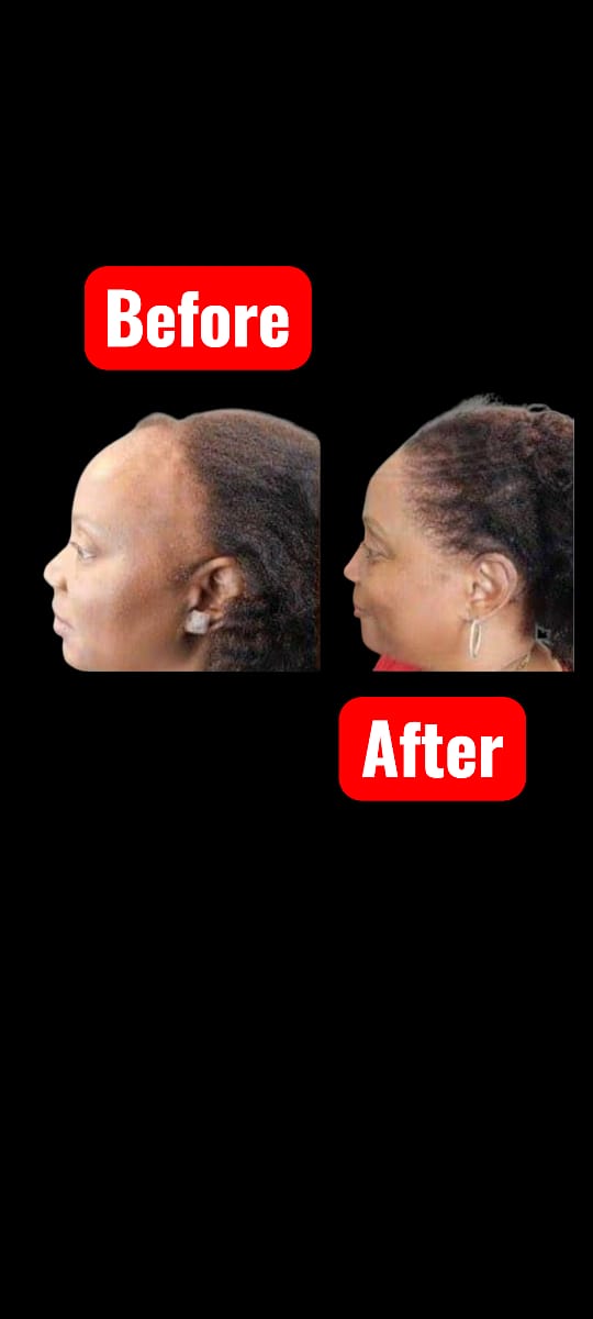 queens grow royal luxury africa before and after 2