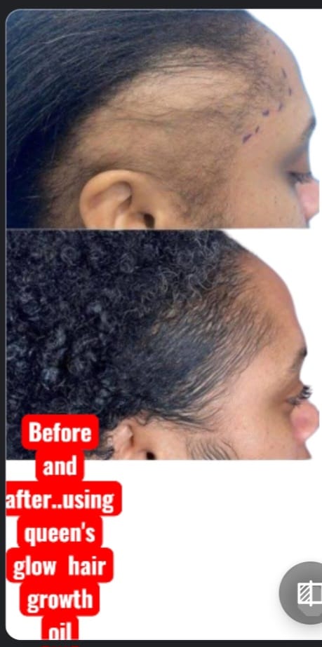 queens grow royal luxury africa before and after 3