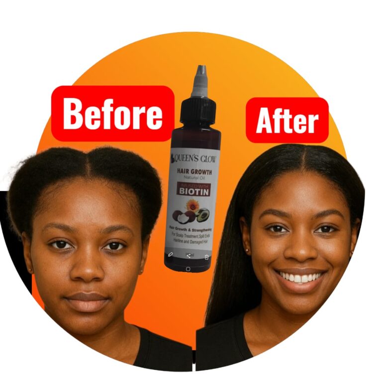 queens grow royal luxury africa before and after