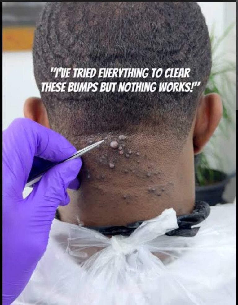 razor treatment royalluxury 3 (2)