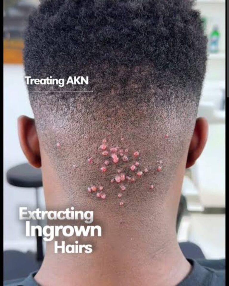 razor treatment royalluxury 3