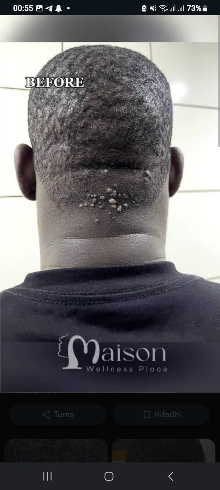 razor treatment royalluxury 4