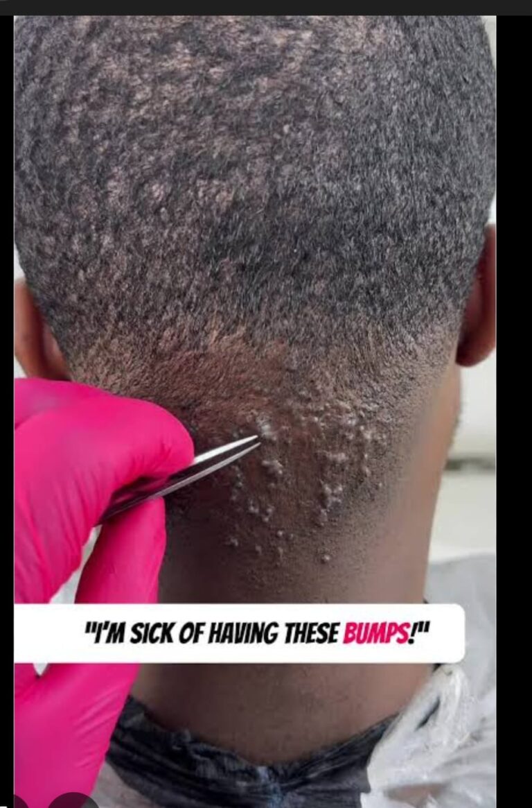 razor treatment royalluxury 5