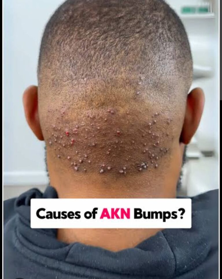 razor treatment royalluxury 6